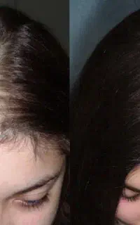 اگه میخواید موهای پرشتی داشته باشید. پیام دهید
