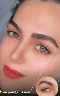 میکرو بلیدینگ فیبروز با ماندگاری بالا بدون درد