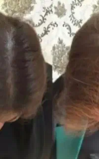 فول تراکم تا ابد