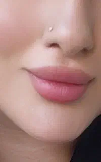 بوتاکس فیلر آبادان و خرمشهر