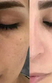 پک اقتصادی