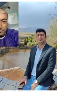 جشنوار کاشت مو ابرو