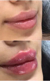 خدمات فیلر و بوتاکس و ماساژ
