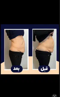 جشنواره لاغری تضمینی۳تا۱۲cmدریک جلسه