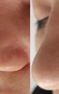 پاکسازی جوانسازی پوست صورت