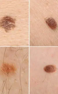 مشکلات پوستی