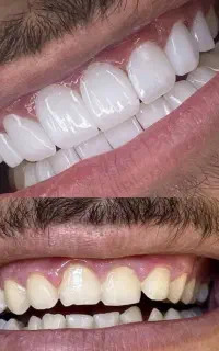 تعرفه‌های کامل خدمات دندانپزشکی