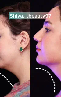 تخفیفات بهاره کلینیک زیبایی دکتر سعیدی