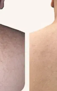 تیرگی هاتو از بین ببر