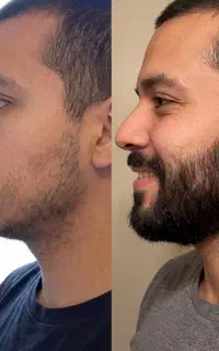 یه تغییر کوچیک یه تفاوت بزرگ