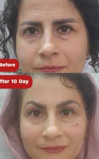 تخفیف ویژه