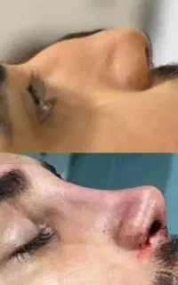 آف جراحی بینی فقط۲۰الا۲۳ت دراهوازلیپوبلفارولابیا
