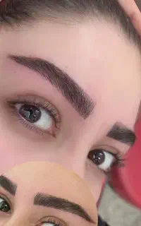 زیبایی دائمی با ظرافت نچرال  بدون درد و تورم