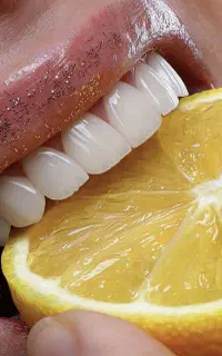 کلینیک دندانپزشکی اقساطی مرمر رویال