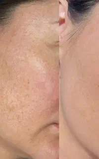فیشال تخصصی صورت و بدن