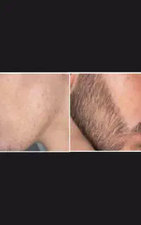 خوشگل کننده واقعی ویژه پسرها