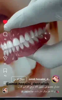 دست دندان متحرک با کیفیت بالا