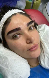 میکرو کاشت ابرو نچرال