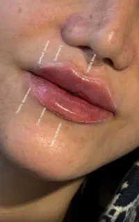 کلینیک زیبایی تخصصی بوتاکس،فیلر، ژل با 15سال سابقه