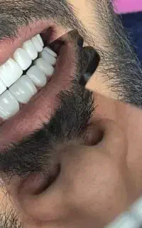 زیبایی دندان ..هر 8 واحد 10میلون