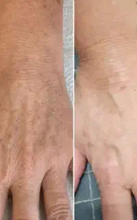 پاک شونده لکه .