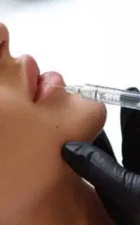 تزریق ژل باپزشک بوتاکس لیزرهایفو