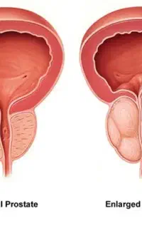 تضمینی،قطعی،همیشگی با تعهد عودت وجه