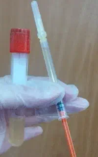 تخفیف مدل تزریق PRP