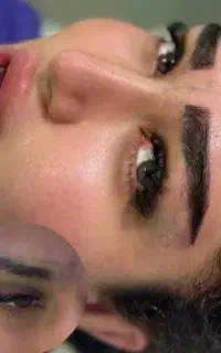 کاشت مو ابرو بلفارو ژل بوتاکس و لیزر،عمل بینی،چربی