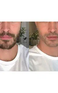 معجزه ریشات دست منه.