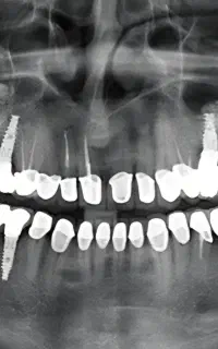 دندانپزشکی اقساطی
