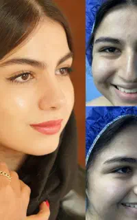 جشنواره عمل بینی درتهران ،بهترین فرصت عمل بینی