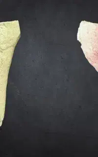 لابراتور دندانسازی (پست)