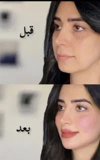 آموزش ژلو بوتاکس نقدواقساط