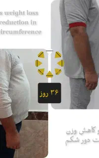 مطب اشرافی