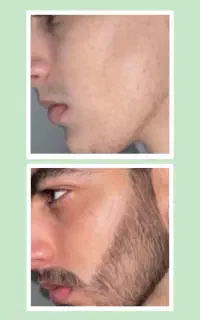 پسر بدون ریش کنسله