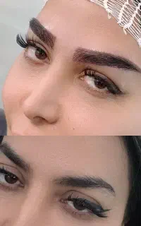 تیم  تخصصی کاشت مو  کاشت ابرو  کاشت ریش  vip