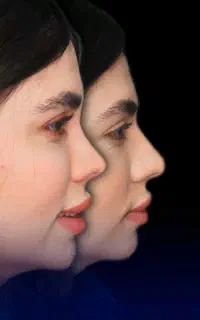 عمل بینی وزیبایی قیمت مناسب