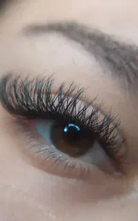 کاشت مژه