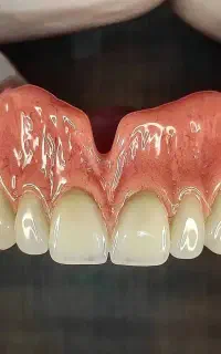 دندان پزشکی و دندانسازی ترمیم