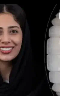 جشنواره عیدانه لبخند ماندگار با طرح عیدقربان