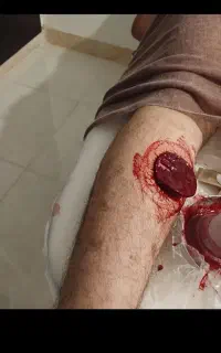 حجامت ماساژ