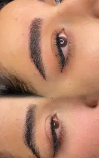 میکروبلیدینگ کرکی مویی (مدل)