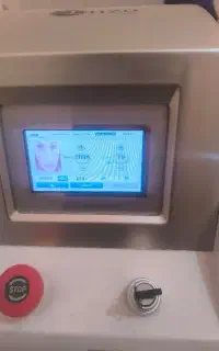پاک کردن تتو،کربن تراپی .با دستگاه پیشرفته کیوسویچ