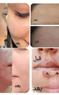 فرصت استثنایی