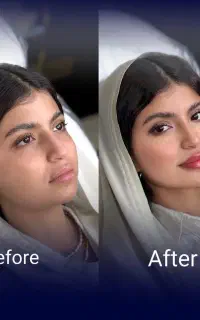جشنواره ژل و بوتاکس با تخفیف استثنایی/اقساطی
