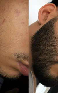 اگه ریش نداری این پیام رو نخون
