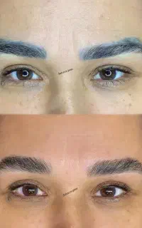 ریمو تک جلسه ایی