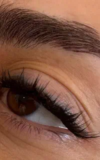کاشت مژه
