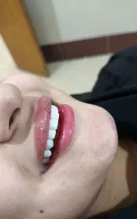 کامپوزیت